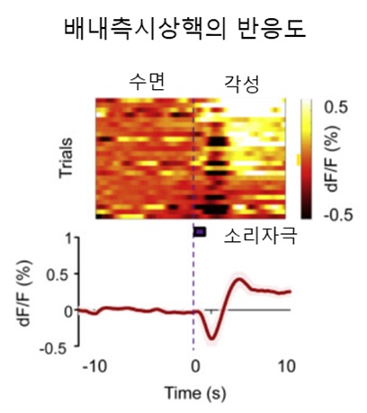 소리자극에 반응하는 GRIK4 배내측 신경. 소리자극이 주어진 시점을 기준으로 GRIK4 배내측 신경의 활성도가 증가하면서 각성효과가 유도된다.(출처=카이스트)